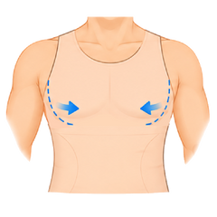 Supports Early-Stage Gynecomastia
